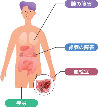 溶血による合併症