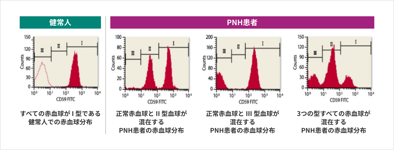 図2：フローサイトメトリーによる健常人とPNH患者の血球分布の比較（海外データ）